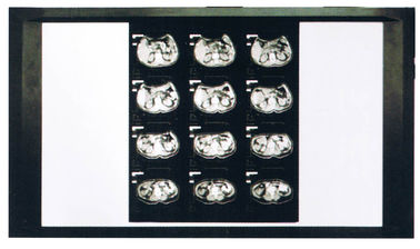 الليزر التشخيصي X راي الجاف السينمائي الطبي لطابعة AGFA / فوجي