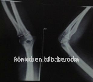 فيلم شفاف للأشعة السينية ، تصوير طبي AGFA / فيلم فوجي X راي الجاف