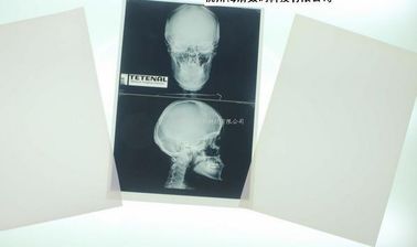 ورقة بيضاء قابلة للتحلل الأشعة السينية ورقة فيلم طبي لطابعة الليزر