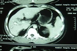 العرف التشخيص الطبي للماء التصوير X فيلم الأشعة السينية للطابعة الحرارية