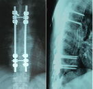 الأشعة السينية الطبية للماء ورقة PET ، فيلم لطابعة الليزر Konida ، فيلم ورقة التصوير الشعاعي