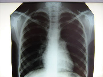 مستشفى واضح للأشعة السينية الطبية فيلم Konida مع الطابعات الحرارية