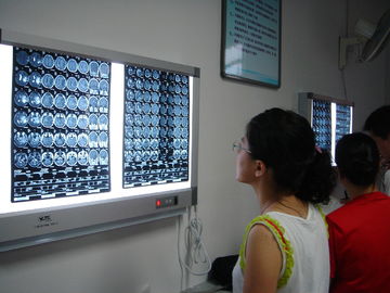 أشعة الليزر الجاف الطبية X Ray Dry 10in x 12in لطابعات فوجي