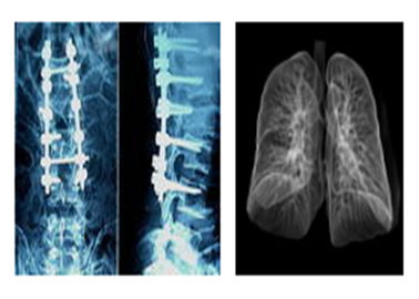 أفلام أشعة X الطبية الشعاعية الحادة ، Mri Dr Ct فيلم التصوير الجاف الرقمي
