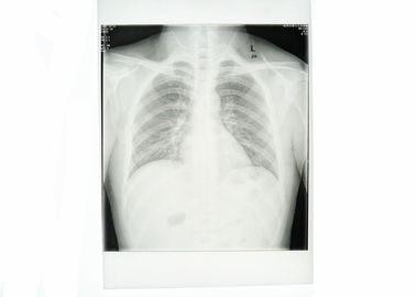 أبيض ورقة طبية الصدر X راي فيلم للماء الحدة العالية