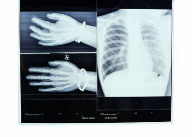 10 × 14 بوصة أفلام الأشعة السينية الطبية الجافة لفوجي 3000/2000/1000