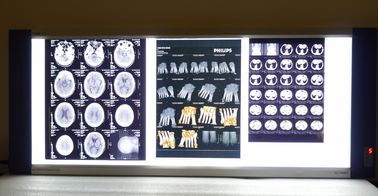 عالية الحدة Konida الأشعة السينية الطبية فيلم الشفافية الجافة لطابعة AGFA / فوجي