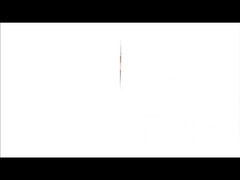 طابعة حرارية للأشعة السينية