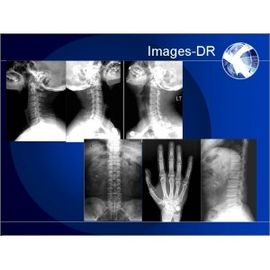 Good price آلة التصوير الشعاعي الرقمي Mammogrpahy X-RAY مع ذراع UC المرن الانترنت