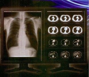 Good price فيلم Ray Clear Digital X Ray ، فيلم الشفافية بالليزر الطبي Konida الانترنت