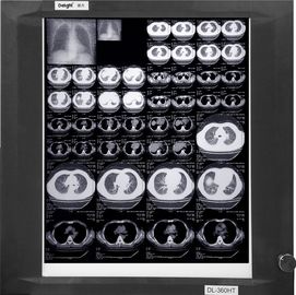 أفلام الأشعة السينية KND-A / F Medical