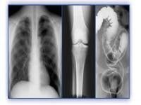 Good price فيلم التصوير الطبي الهولوغرافي ، طابعات حرارية PET X Ray Film الانترنت