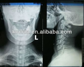 Good price التصوير التشخيصي الطبي عالي الحدة ، فيلم AGFA X Ray الجاف الانترنت