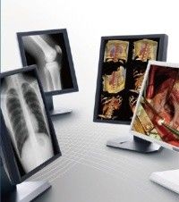 Good price صورة واضحة تعرض الدرجة الطبية ، شاشة طبية بمقياس رمادي 5 ميجا بكسل الانترنت