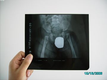 الأشعة السينية منخفضة فيلم التصوير الطبي الجاف الأشعة السينية للطابعة AGFA / فوجي / كوداك
