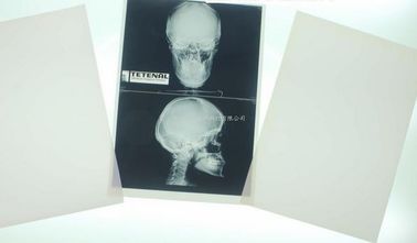 11 × 14 التصوير الطبي التشخيصي بالليزر لطابعة الليزر Konida