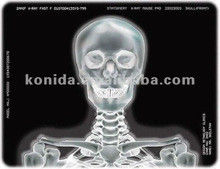 Good price فيلم الطابعة الحرارية للأشعة السينية الطبية KND-F25*30cm الانترنت