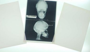 Good price كونيدا 10in X 12in X Ray التصوير الطبي الانترنت