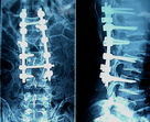 Good price أفلام Blue AGFA Medical X Ray 10in x 12in ، عالية الحدة الانترنت