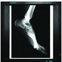 أجفا الجاف للأشعة السينية الرقمية فيلم الطبية ، CE / SFDA / ISO 13485