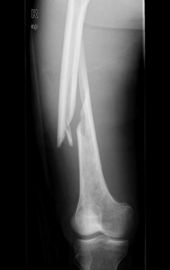 Good price تصوير Konida Laser X Ray الطبي الانترنت