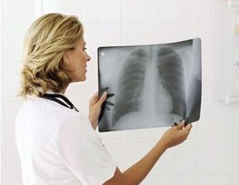 Good price 20 سم × 25 سم X راي التصوير التشخيصي الانترنت