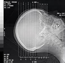 الأشعة الفضية هاليد ليزر X راي التصوير التشخيصي ، A3 / A4 فيلم الشفافية للماء
