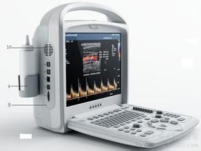 Good price نظام الموجات فوق الصوتية دوبلر الملونة 3D / 4D متعدد الترددات مع محول طاقة الموجات فوق الصوتية المركزة الانترنت