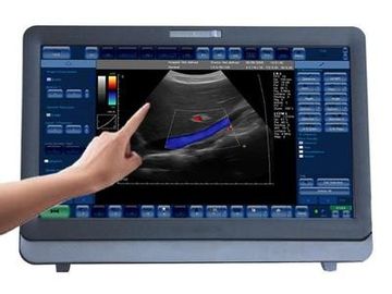 Good price نظام الموجات فوق الصوتية دوبلر بالألوان الطبية 3D / 4D المحمولة مع شاشة LED مقاس 15 بوصة الانترنت