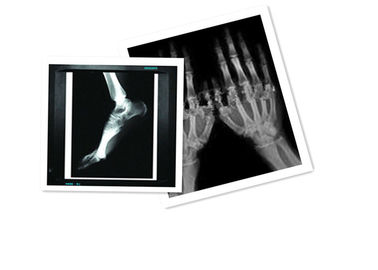 Hosipital PET Film Medical X Ray Paper مقاوم للماء 8 × 10 بوصة CT فيلم أبيض