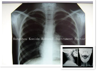 الأشعة السينية الطبية الرقمية السينمائي الجاف 14 × 17 بوصة فيلم التصوير الصحي بالأشعة