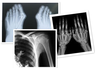 الأشعة السينية الحرارية الرقمية فيلم فوجي الطبية لفحص الأشعة