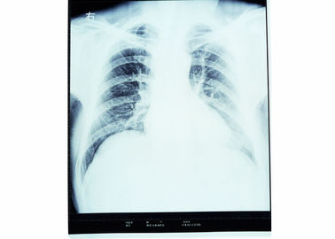 Good price الأشعة السينية الطبية للتصوير الجاف للأشعة السينية لـ AGFA 5300/5302/5500 KND-A الانترنت