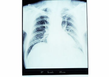 التصوير التشخيصي الطبي عالي الحدة ، فيلم AGFA X Ray الجاف