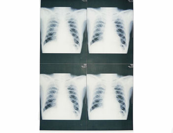 أفلام الأشعة السينية الطبية القابلة للارتداء ذات القاعدة البيضاء ، فيلم ورق التصوير بالأشعة السينية الطبية