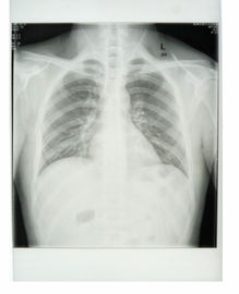 Good price طابعة Konida Laser Printer X-Ray Film 11in x 14in KND-K CE المعتمدة الانترنت