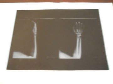 KND-A فيلم التصوير الطبي الجاف المنخفض الضباب لفحص الأشعة السينية على AGFA 5300 11in × 14in